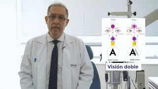 Diplopía - Visión doble - Neuro oftalmología