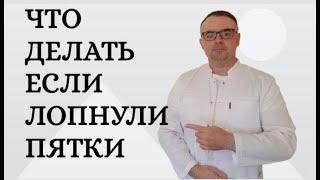 Что делать если лопнули пятки