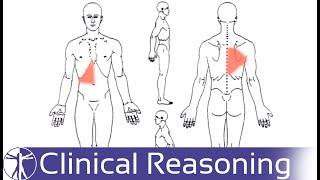 Screening for Visceral Referred Pain in the Thoracic Spine