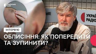 Сивина, облисіння, пересадка волосся | Cекрети стилістів Кучми та Трампа | В’ячеслав Дюденко