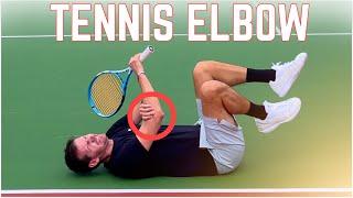 The 4 Main Causes of Tennis Elbow