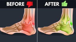 How To Un-F*ck Your Achilles - The Best Fix For Tendinopathy & Chronic Pain