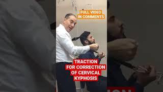 How to Correct Cervical Kyphosis | Dr. Walter Salubro Chiropractor in Vaughan, ON