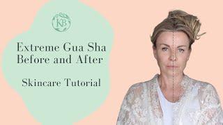 Extreme Gua Sha Before and After   Skincare Tutorial by Katie Brindle