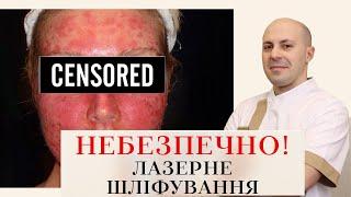 ЛАЗЕРНЕ ШЛІФУВАННЯ: ЯК СКОРОТИТИ РЕАБІЛІТАЦІЮ ⁉️  ЯК ОБРАТИ АПАРАТ