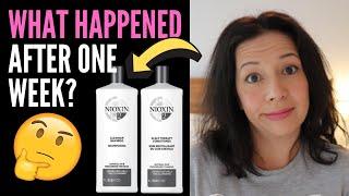 HAIR LOSS SUFFERER REVIEWS NIOXIN SHAMPOO, CONDITIONER + SCALP/HAIR TREATMENT 2: BEFORE and AFTER!