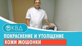  Покраснение и утолщение кожи мошонки. Клинический случай №215