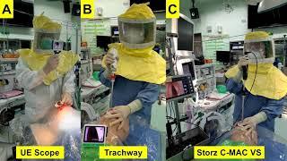 Plastic sheet and video intubating stylet: A technical note -2