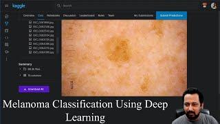 Detecting Skin Cancer (Melanoma) With Deep Learning