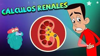 Cálculos Renales y lo que debes saber | Educativos para niños