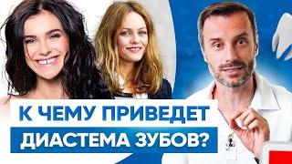 Как убрать щель между зубами? Диастема зубов – все что нужно знать!