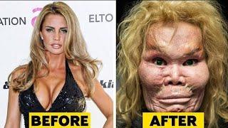 Celebrity plastic surgery disaster