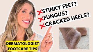 Footcare Tips for Cracked Heels, Smelly Feet, Toenail Fungus & More | Dermatologist Dr. Sam Ellis