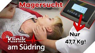 MAGERSÜCHTIG nach OP! Magenband der Patientin muss SOFORT RAUS! | Klinik am Südring | SAT.1