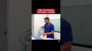 BMV Technique for Small Hands | #anesthesia #bagmaskventilation #airway