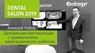 DENTAL SALON 2019 - лекция А. Рябова «Дентальная имплантация с применением навигационного шаблона»