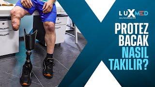 How to put a Prosthetic Leg | Luxmed Protez