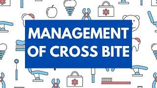 Management of Cross Bite -Orthodontics