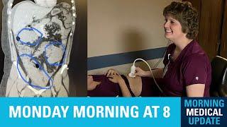 Morning Medical Update - Ovarian Cancer