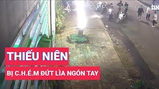 Điều tra vụ thiếu niên 15 tuổi ở quận Gò Vấp bị chém đứt lìa ngón tay.