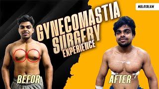 My Gynaecomastia Experience: Experience, Treatment and Surgery | Malayalam