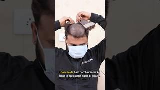 Hair patch service at home| Hair Patch Self Service| Hair Patch Service #hairloss