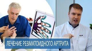 ЛЕЧЕНИЕ РЕВМАТОИДНОГО АРТРИТА | Способы лечения