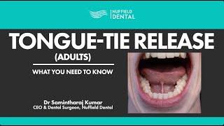 Tongue-Tie Release for Adults: What You Need To Know (FULL)