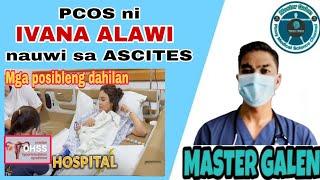 Sakit ni Ivana Alawi, PCOS pano nagkaka Ascites