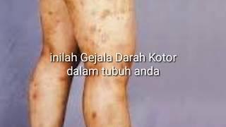 Wajib tahu inilah gejala darah kotor dalam tubuh anda