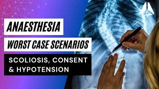 Scoliosis, Consent and Hypotension | Anaesthesia Worst Case Scenarios #anesthesiology #anesthesia
