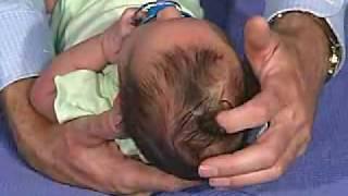 physical exam -Newborn Normal:  Head Shape and Sutures