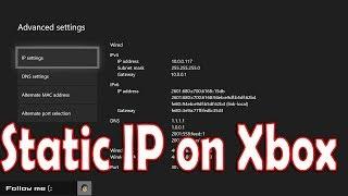 How to Setup Static IP on Xbox One