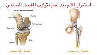 استمرار الألم بعد عملية تبديل الركبة أو الورك
