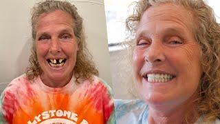 WOW Christy Can Smile Again! Smile Makeover!