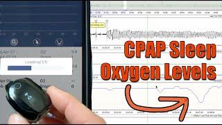 Easily Record and View Oxygen Levels with CPAP: Wellue Viatom O2 Ring SPO2 Monitor For Sleep Apnea