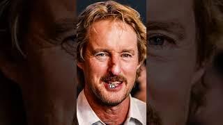 ¿Qué le pasó a la NARIZ de OWEN WILSON? 