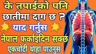 Medical Test in Poland । Labour Medical test in poland । Chest spot for Visa