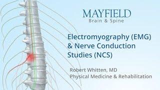 Electromyography (EMG) & Nerve conduction studies (NCS)