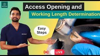 Access Opening & Working Length Determination in Maxillary Central Incisor | Demo