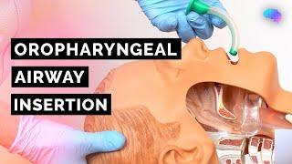 Oropharyngeal Airway Insertion | Guedel | OPA | ABCDE Emergency | OSCE Guide | UKMLA | CPSA