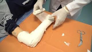 ПСА Наложение гипсовых повязок при закрытых переломах костей конечностей Травматология и ортопедия