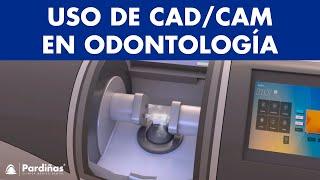 CAD/CAM dental - Cómo realizar PRÓTESIS DENTALES por ordenador ©