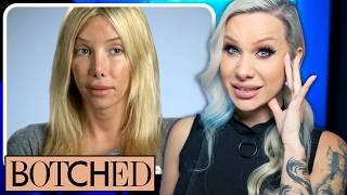 BOTCHED! Is 24 trans plastic surgeries too many? volume 3