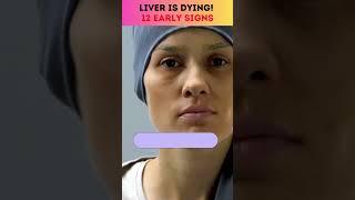 12 Early signs your liver is dying #liverdamage #liverhealth @youtubecreators #YouTubeHighFive