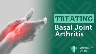 Basal Joint Arthritis