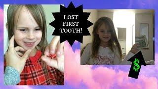 Capri LOST Her FIRST TOOTH!!!