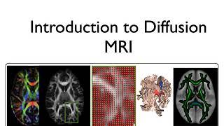 36. Diffusion 1: Introduction to DTI in FSL (Diff E1)