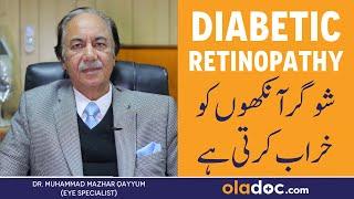 How Diabetes Affects Your Eyes - Sugar Ka Ankhon Per Asar - Diabetic Retinopathy Treatment In Urdu