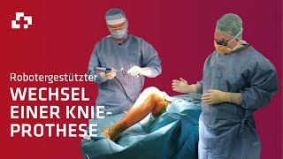 Roboterassistierter Wechsel einer Knieprothese